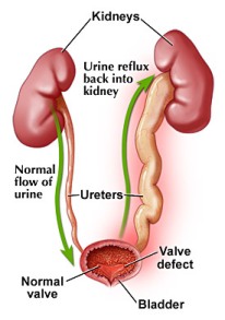 Urine flow
